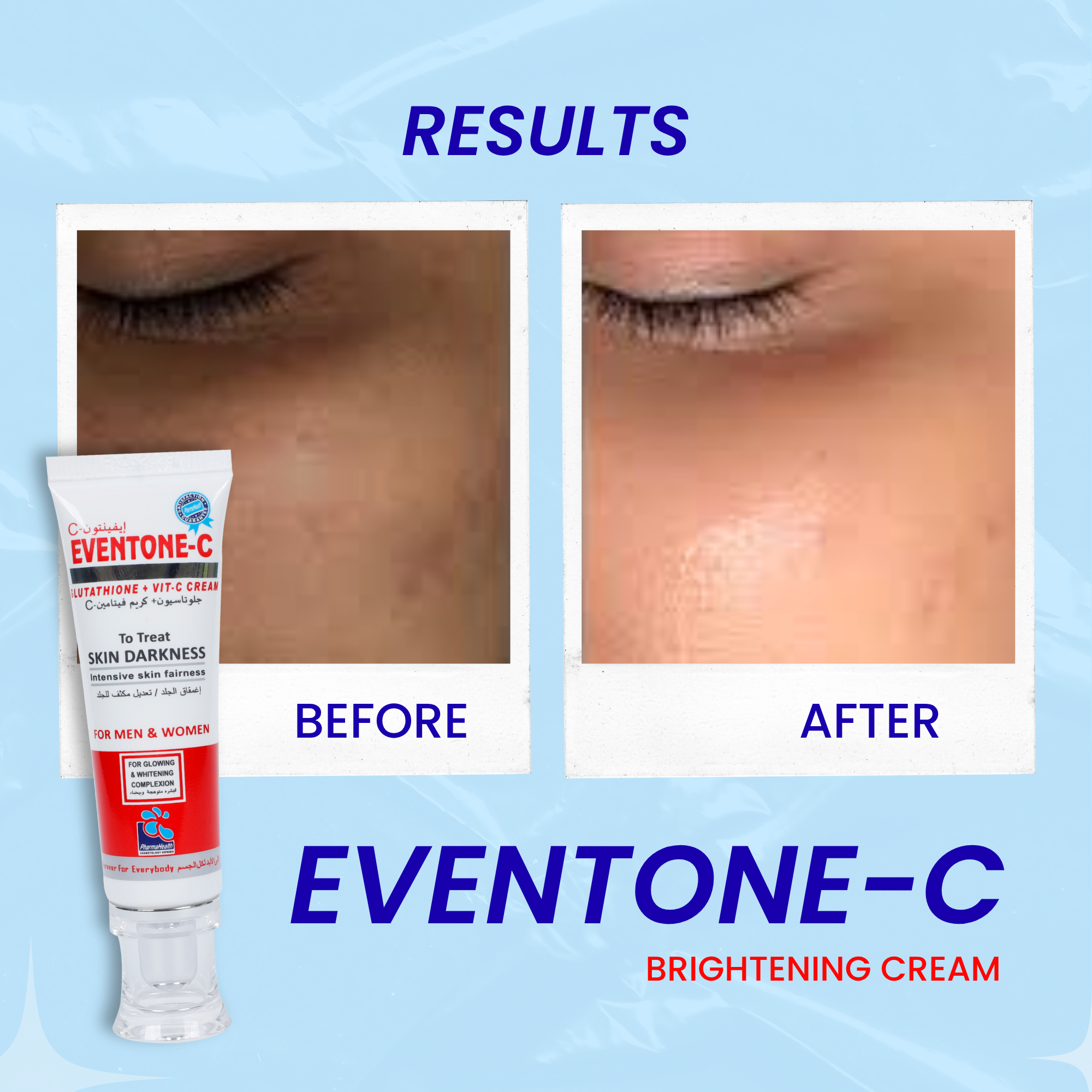 Eventone C Cream ( Skin whitening )
