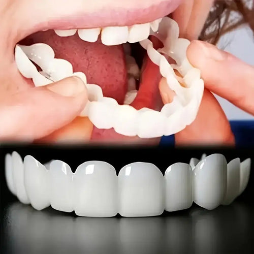 1 Pair (2 Pieces ) Realistic Dental Veneers – Upper & Lower Teeth, Snap on Smile