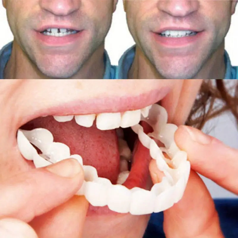 1 Pair (2 Pieces ) Realistic Dental Veneers – Upper & Lower Teeth, Snap on Smile